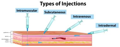 types-of-injections-diagram-vector.jpg