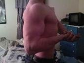 shoulder before.jpg