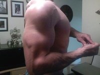 shoulder after.jpeg