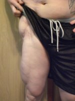 richie's leg1.jpg