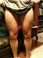 vascularity.jpg