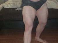richie's leg4.JPG