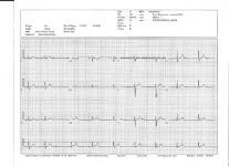 EKG 11-21-13.jpg