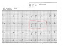 EKG 9-26-14.jpg