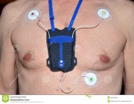 holter-heart-monitor-48764943.jpg