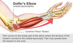 Golfers-Elbow-pain-treatment-doctor.jpg