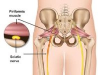 Periformis.jpg