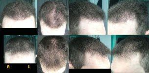 Hair 61 4-13-20 Pre-Revision.jpg